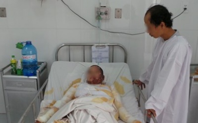 Cứu thai nhi trong bụng sản phụ bị bỏng nặng